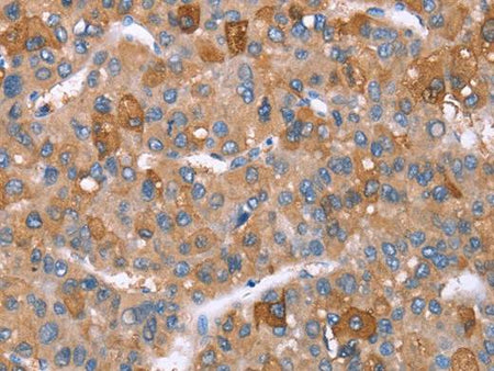GPC6 Polyclonal Antibody Store at -20°C Host Rabbit