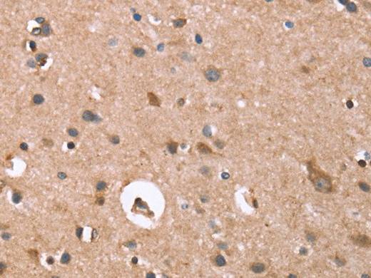GPC6 Polyclonal Antibody Store at -20°C Host Rabbit