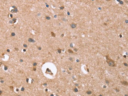 GPC6 Polyclonal Antibody Store at -20°C Host Rabbit