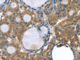 GNAT3 Polyclonal Antibody
