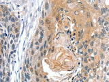 GNAT3 Polyclonal Antibody