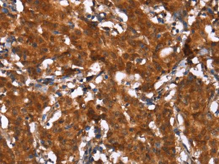 HCAR2 Polyclonal Antibody