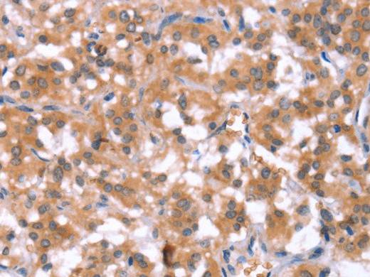 HCAR2 Polyclonal Antibody