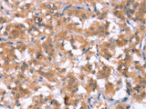 HCAR2 Polyclonal Antibody