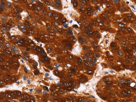 GPR124 Polyclonal Antibody - Biomarkers - Elabscience Biotechnology - MSE Supplies
