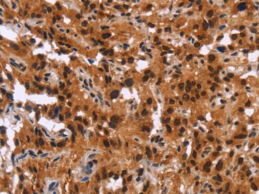GPR124 Polyclonal Antibody - Biomarkers - Elabscience Biotechnology - MSE Supplies