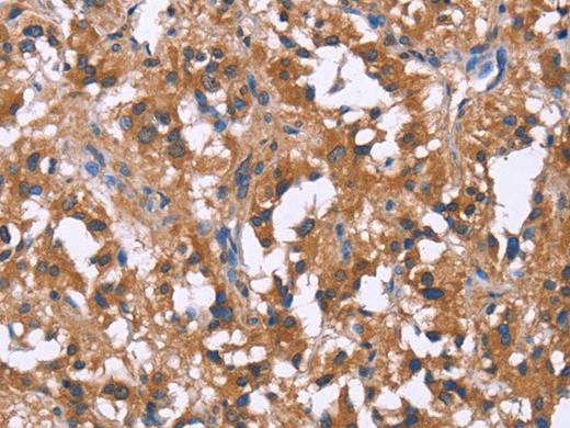 GPR172B Polyclonal Antibody