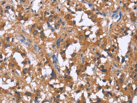 GPR172B Polyclonal Antibody