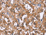 GPR172B Polyclonal Antibody