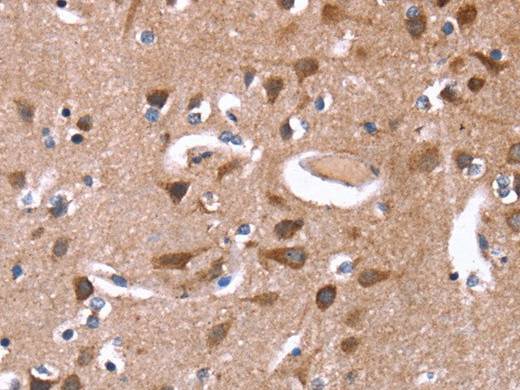 GREB1 Polyclonal Antibody