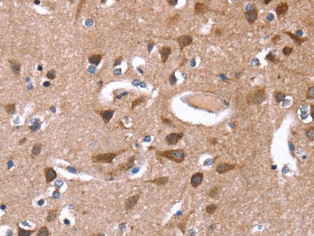 GREB1 Polyclonal Antibody