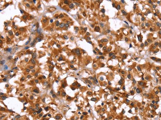 GUK1 Polyclonal Antibody Store at -20°C Host Rabbit