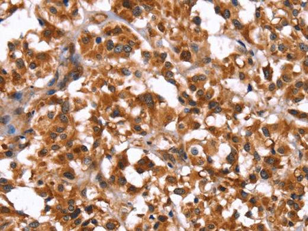 GUK1 Polyclonal Antibody Store at -20°C Host Rabbit