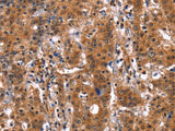 GUK1 Polyclonal Antibody Store at -20°C Host Rabbit