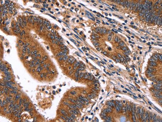 HACE1 Polyclonal Antibody Store at -20°C Host Rabbit