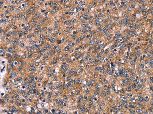 HACE1 Polyclonal Antibody Store at -20°C Host Rabbit