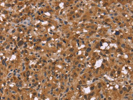 HDLBP Polyclonal Antibody Store at -20°C