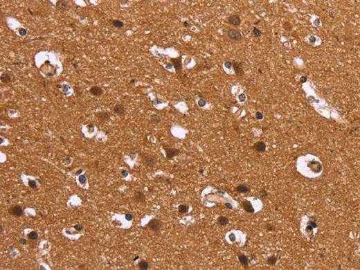 HDLBP Polyclonal Antibody Store at -20°C