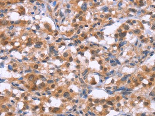 BRK1 Polyclonal Antibody Store at -20°C Host Rabbit
