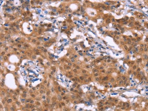 BRK1 Polyclonal Antibody Store at -20°C Host Rabbit