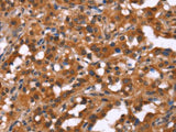 HINT1 Polyclonal Antibody Store at -20°C Host Rabbit