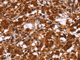 HIPK1 Polyclonal Antibody