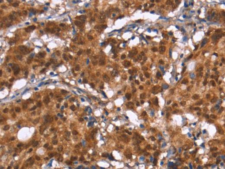 HIPK1 Polyclonal Antibody