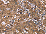 HLTF Polyclonal Antibody