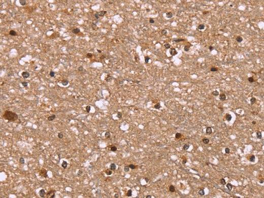 HLTF Polyclonal Antibody