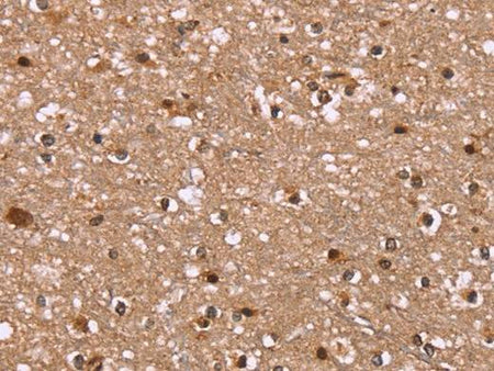 HLTF Polyclonal Antibody