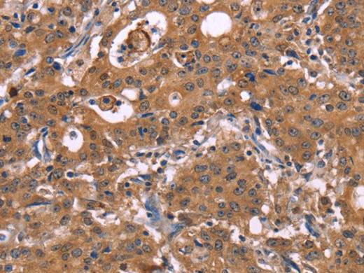 HMGCS1 Polyclonal Antibody Store at -20°C Host Rabbit