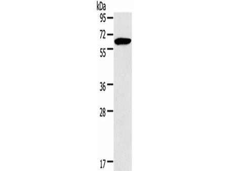 HMGCS2 Polyclonal Antibody Store at -20°C