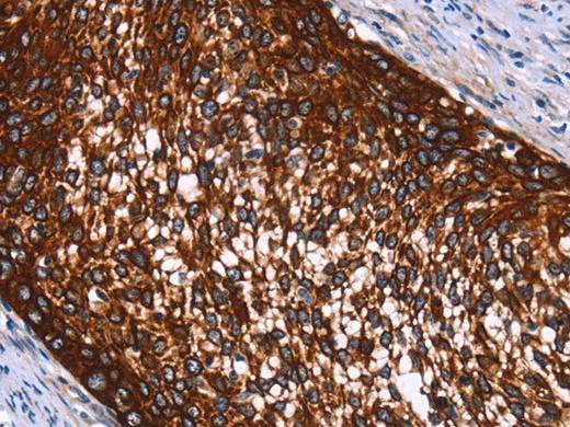 HMGCS2 Polyclonal Antibody Store at -20°C