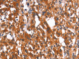 HMGCS2 Polyclonal Antibody Store at -20°C