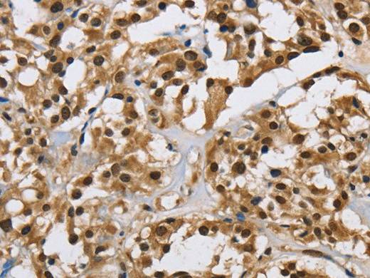 HNRNP L Polyclonal Antibody