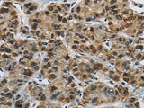 HNRNP L Polyclonal Antibody