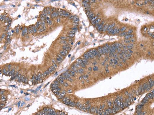 HRG Polyclonal Antibody Store at -20°C Host Rabbit