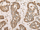 CAPN9 Polyclonal Antibody
