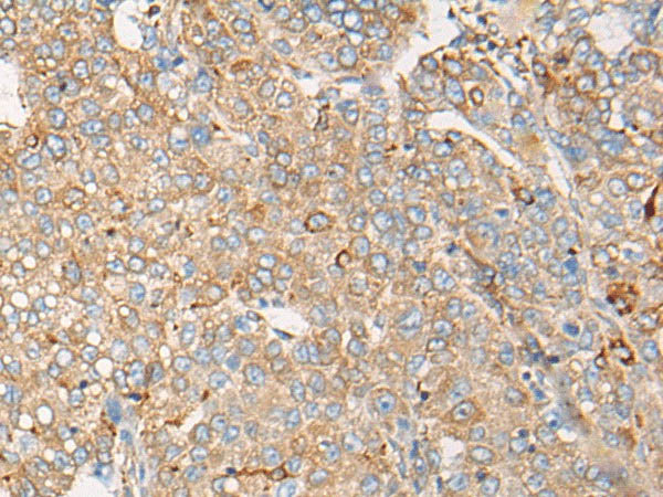 CAPN9 Polyclonal Antibody