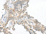 CAMK2A Polyclonal Antibody