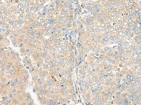 CAMK2A Polyclonal Antibody