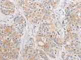 CPD Polyclonal Antibody