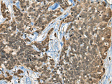CBFA2T3 Polyclonal Antibody