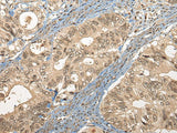 CC2D1A Polyclonal Antibody