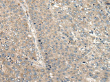 CC2D1A Polyclonal Antibody