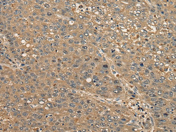 CCDC85C Polyclonal Antibody