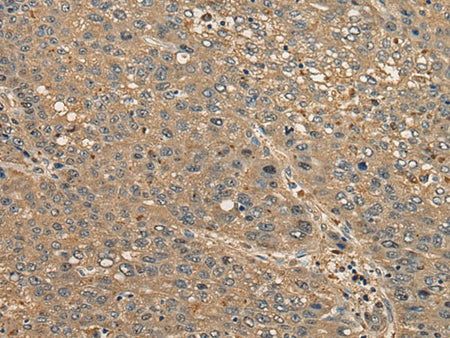 CCDC85C Polyclonal Antibody