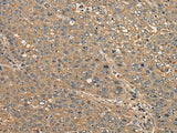 CCDC85C Polyclonal Antibody