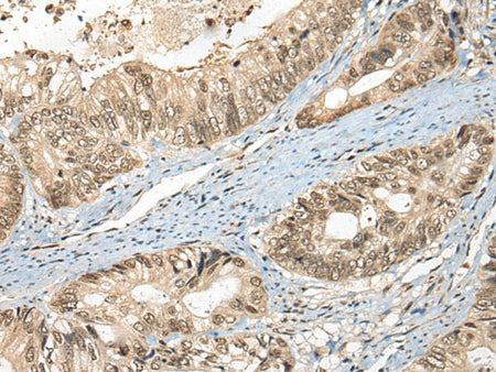 FUT4 Polyclonal Antibody