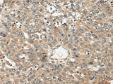 FUT4 Polyclonal Antibody